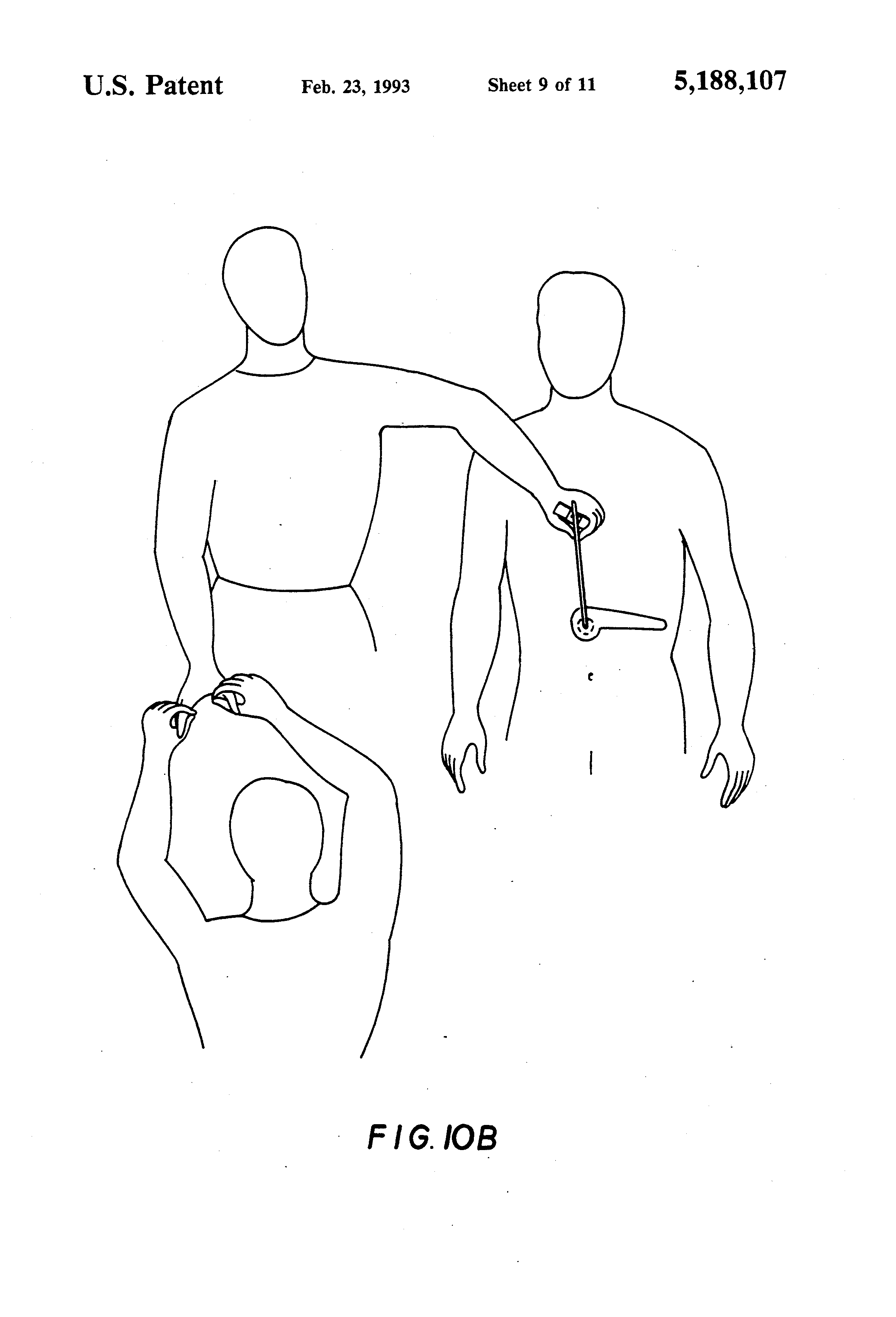 Dibujos ilustrativos del "método diagnóstico" patentado.
